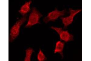 ABIN6274603 staining Hela by IF/ICC.