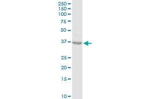 CCRK MaxPab rabbit polyclonal antibody.
