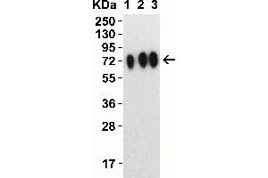 Western Blot Validation with SARS-CoV-2 (COVID-19) Spike Recombinant Protein Loading: 30 ng per lane of SARS-CoV-2 (COVID-19) Spike RBD+SD1+SD2 recombinant protein, 10-305.