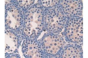 Detection of SLPI in Mouse Testis Tissue using Polyclonal Antibody to Secretory Leukocyte Peptidase Inhibitor (SLPI)