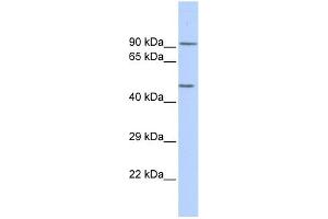 WB Suggested Anti-KCNJ8 Antibody Titration: 0. (KCNJ8 anticorps  (Middle Region))
