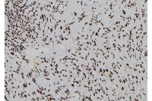 ABIN6278246 at 1/100 staining Human gastric tissue by IHC-P. (Dual Specificity Phosphatase 3 (DUSP3) (N-Term) anticorps)