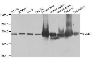 Western blot analysis of extracts of various cell lines, using GLUD1 antibody. (GLUD1 anticorps  (AA 54-240))