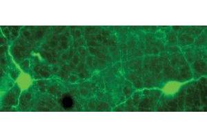 Immunostaining of rabbit retina showing specific labeling of tyrosine hydroxylase in green.