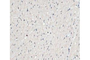 Immunohistochemistry of paraffin-embedded Rat heart using DMD Polyclonal Antibody at dilution of 1:100 (40x lens).
