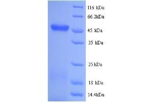 SDS-PAGE (SDS) image for Chromosome 22 Open Reading Frame 28 (C22orf28) (AA 1-408), (full length) protein (His tag) (ABIN5714126)