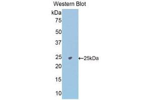 Western Blotting (WB) image for anti-N-Acetylgalactosaminidase, alpha (NAGA) (AA 18-217) antibody (ABIN1176641) (NAGA anticorps  (AA 18-217))