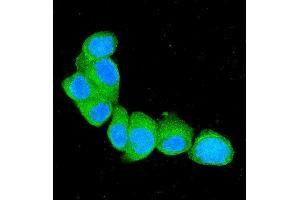 IF analysis of S100A4 using anti-S100A4 antibody (ABIN7600462). (s100a4 anticorps  (AA 2-101))