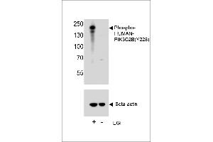Western blot analysis of lysate from A431 cell line, using Phospho-HUN-PIK3C2B (ABIN6241073 and ABIN6578945). (PIK3C2B anticorps  (pTyr228))