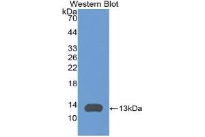 Western blot analysis of the recombinant protein. (CXCL11 anticorps  (AA 22-100))