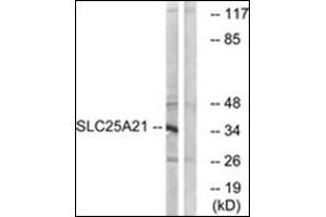 Western blot analysis of extracts from HepG2 cells, using SLC25A21 Antibody   The lane on the right is treated with the synthesized peptide. (SLC25A21 anticorps  (Internal Region))