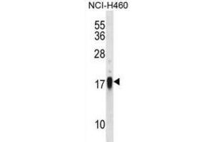 Western Blotting (WB) image for anti-CD70 Molecule (CD70) antibody (ABIN2998201)