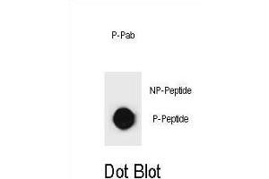 Dot blot analysis of KIT Antibody (Phospho ) Phospho-specific Pab (ABIN1881481 and ABIN2850471) on nitrocellulose membrane. (KIT anticorps  (pSer891))