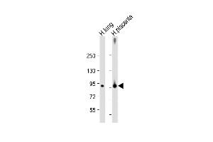 All lanes : Anti-F13A1 Antibody (N-Term) at 1:2000 dilution Lane 1: Human lung lysate Lane 2: Human placenta lysate Lysates/proteins at 20 μg per lane. (F13A1 anticorps  (AA 170-204))