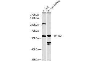 Western blot analysis of extracts of various cell lines, using R antibody (ABIN6129727, ABIN6146710, ABIN6146711 and ABIN6224588) at 1:1000 dilution. (RARS2 anticorps  (AA 17-340))
