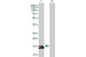 Lane 1: MGC35295 transfected lysate ( 15. (MGC35295 293T Cell Transient Overexpression Lysate(Denatured))
