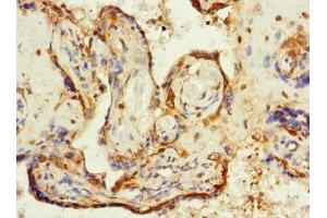 Immunohistochemistry of paraffin-embedded human placenta tissue using ABIN7176726 at dilution of 1:100