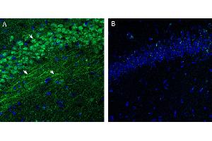 anti-Sphingosine-1-Phosphate Receptor 3 (S1PR3) (AA 23-34), (Extracellular), (N-Term) antibody
