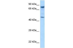 WB Suggested Anti-Skil Antibody Titration: 1.