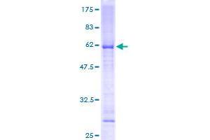Image no. 1 for Mitochondrial Ribosomal Protein L19 (MRPL19) (AA 1-292) protein (GST tag) (ABIN1311302)