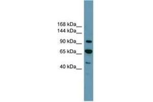 Image no. 1 for anti-Retinoblastoma Protein (Rb Protein) (C-Term) antibody (ABIN6744235) (Retinoblastoma Protein (Rb) anticorps  (C-Term))