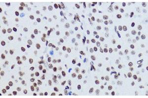 Immunohistochemistry of paraffin-embedded Rat ovary using Acetyl-Histone H2B-K12 Polyclonal Antibody at dilution of 1:200 (40x lens).