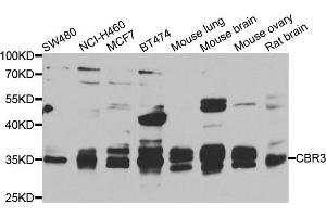 Western blot analysis of extracts of various cell lines, using CBR3 antibody. (CBR3 anticorps)