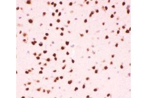 IHC-P testing of mouse brain tissue (ATF2 anticorps  (AA 93-450))