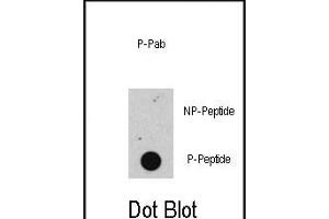 Dot blot analysis of anti-Phospho-RB- Antibody (ABIN389642 and ABIN2839634) on nitrocellulose membrane. (Retinoblastoma 1 anticorps  (pSer608))