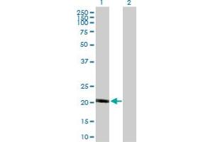 Western Blot analysis of NDUFB10 expression in transfected 293T cell line by NDUFB10 MaxPab polyclonal antibody.