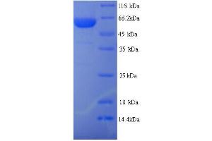 SDS-PAGE (SDS) image for Tripartite Motif Containing 21 (TRIM21) (AA 1-475), (full length) protein (His tag) (ABIN5713912)