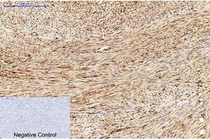 Immunohistochemical analysis of paraffin-embedded human uterus tissue. (MICU1 anticorps)