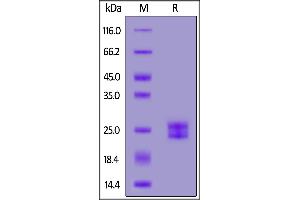 Human IL-11, His Tag on  under reducing (R) condition. (IL-11 Protein (AA 22-199) (His tag))