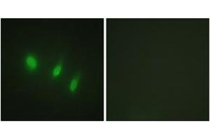 Immunofluorescence (IF) image for anti-Forkhead Box O4 (FOXO4) (AA 417-466) antibody (ABIN2888912) (FOXO4 anticorps  (AA 417-466))