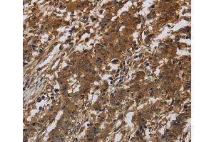 Immunohistochemistry (IHC) image for anti-Integrin beta 7 (ITGB7) antibody (ABIN2433217) (Integrin beta 7 anticorps)