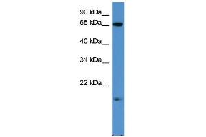 WB Suggested Anti-RHOXF1 Antibody Titration: 0.