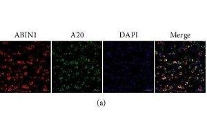 ABIN1 is colocated with A20 and NeuN and Iba-1, respectively, in the peri-infarct cortex.