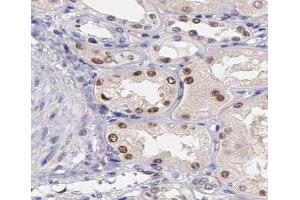 ABIN6267387 at 1/200 staining human kidney tissue sections by IHC-P. (ATF2 anticorps  (pSer44, pSer62))