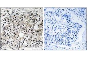 Immunohistochemistry analysis of paraffin-embedded human breast carcinoma tissue, using PECI Antibody.