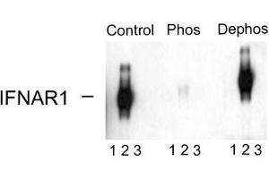 Image no. 1 for anti-Interferon alpha/beta Receptor 1 (IFNAR1) (pSer535), (pSer539) antibody (ABIN372660) (IFNAR1 anticorps  (pSer535, pSer539))