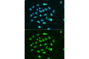 Immunofluorescence analysis of HeLa cell using H3K9ac antibody.