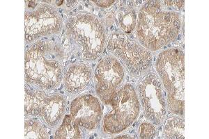 ABIN6266517 at 1/200 staining human kidney tissue sections by IHC-P. (Connexin 43/GJA1 anticorps  (Internal Region))