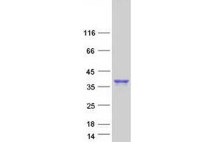 Validation with Western Blot