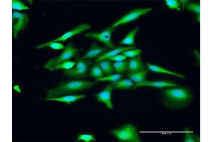Immunofluorescence of purified MaxPab antibody to GUCA1C on HeLa cell. (GUCA1C anticorps  (AA 1-209))