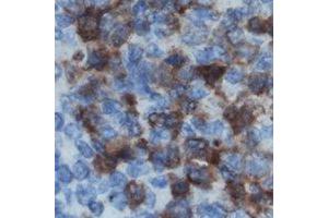 Immunohistochemical analysis of DOK2 staining in human lymph node formalin fixed paraffin embedded tissue section. (DOK2 anticorps)