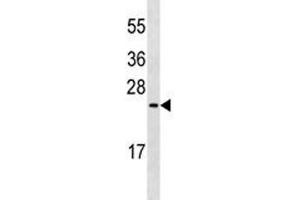 MUC1 antibody western blot analysis in MDA-MB435 lysate.