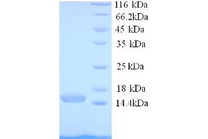SDS-PAGE (SDS) image for Pterin-4 alpha-Carbinolamine Dehydratase/dimerization Cofactor of Hepatocyte Nuclear Factor 1 alpha (PCBD1) (AA 2-104) protein (His tag) (ABIN5713714) (PCBD1 Protein (AA 2-104) (His tag))