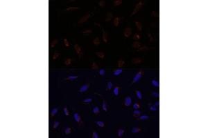 Immunofluorescence analysis of U-2 OS cells using  antibody (ABIN6131164, ABIN6136413, ABIN6136415 and ABIN6217209) at dilution of 1:100.