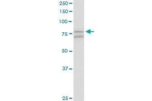 SCYL1 monoclonal antibody (M02), clone 2E5. (SCYL1 anticorps  (AA 373-472))