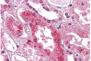 Human Kidney: Formalin-Fixed, Paraffin-Embedded (FFPE) (GM2A anticorps  (C-Term))